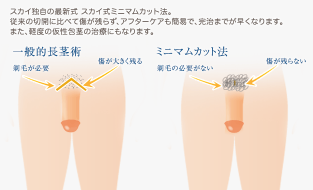 ミニマムカット法